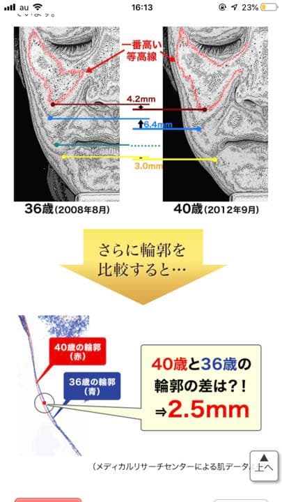 EMS搭載美顔器 エステアップ 4