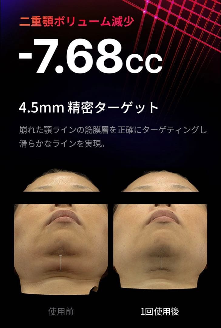 メディキューブ medicube AGE-R ハイフォーカスショット 美顔器