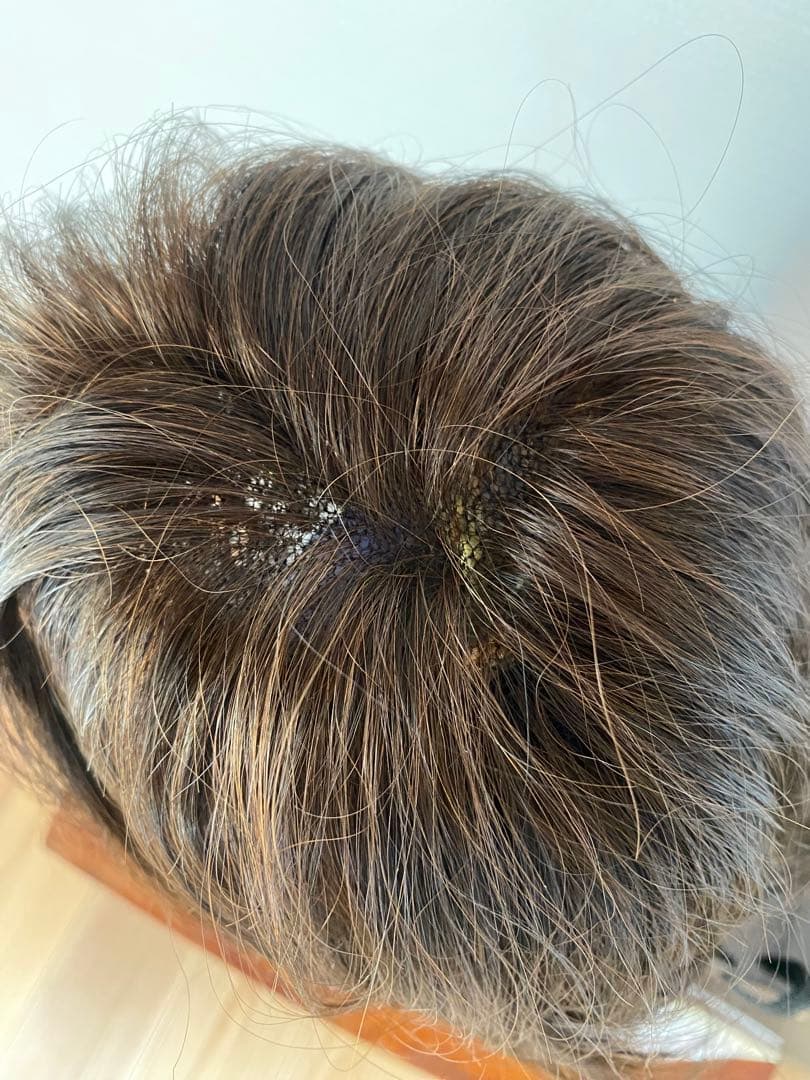 【未使用に近い】フォンテーヌ ウィッグ