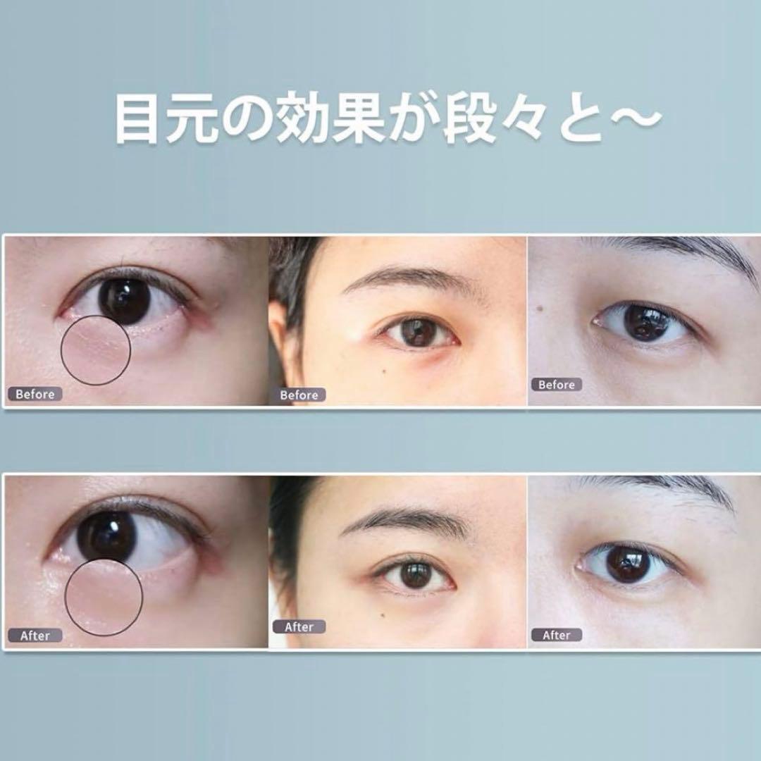 美顔器 目元ケア 目もと集中ケア 目元エステ イオン導入 超音波美顔器