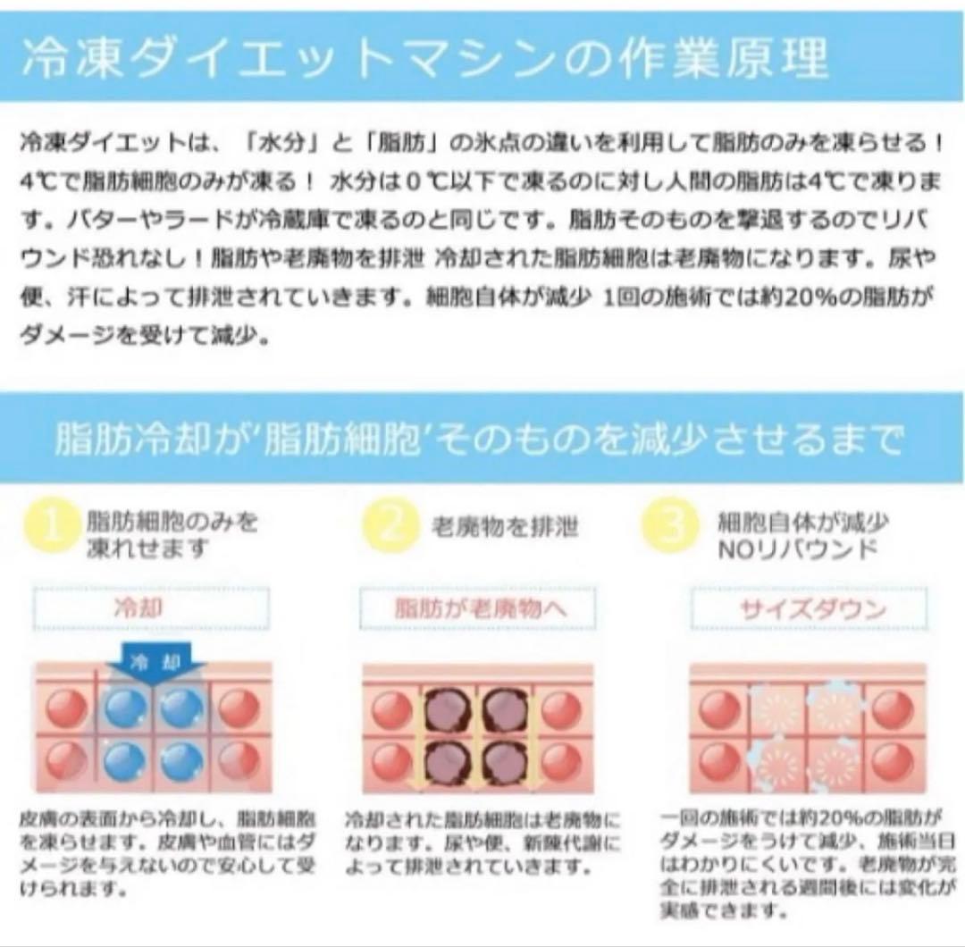 家庭用キャビテーション 冷凍ダイエットマシン 脂肪冷却