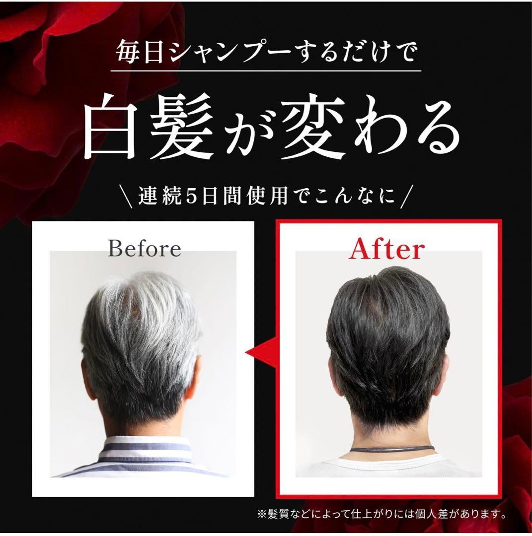 KUROクリームシャンプー 3個セット 400gX3