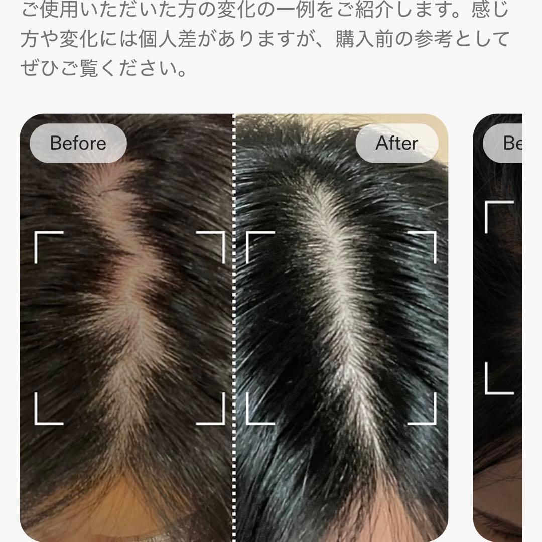 CurrentBody Skin LED頭皮・頭髪ケアデバイス