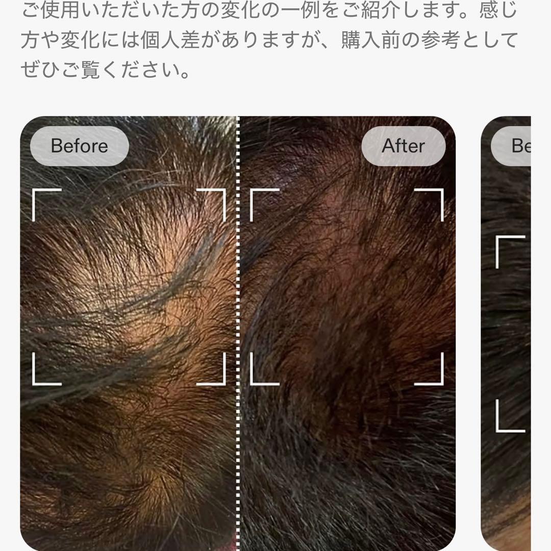 CurrentBody Skin LED頭皮・頭髪ケアデバイス