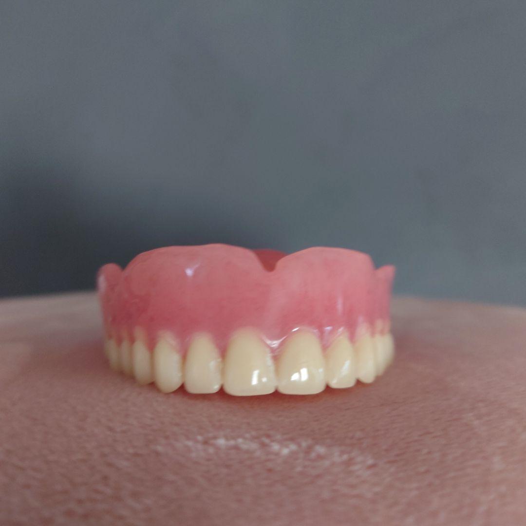 たむ　歯科技工　総義歯　5床