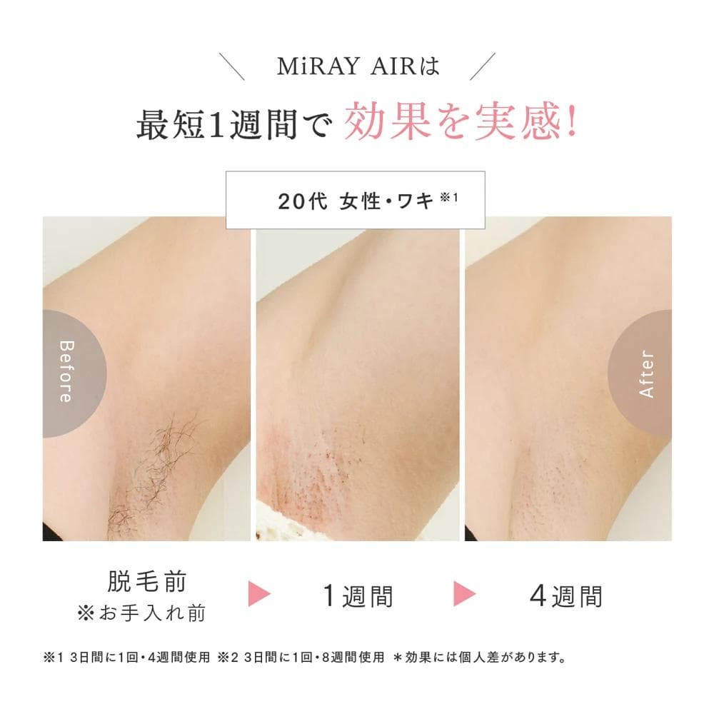 新品未使用 MYTREX MiRAY AIR マイトレックス ミライ 美顔器